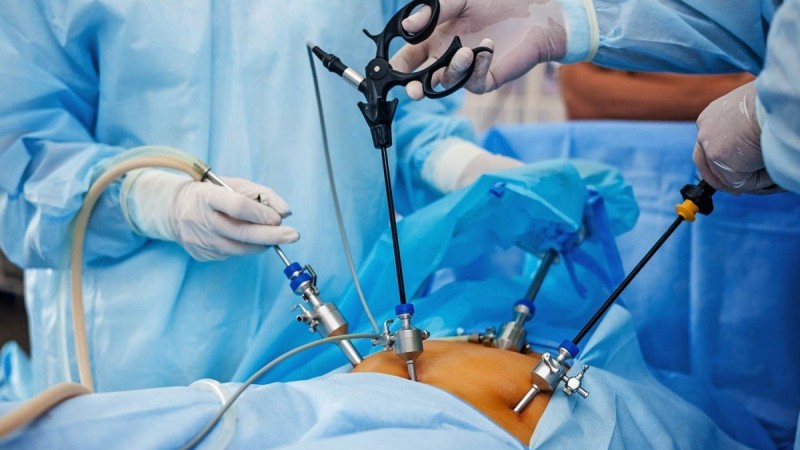 5 499 камней из желчного пузыря пациента извлекли врачи Алматы