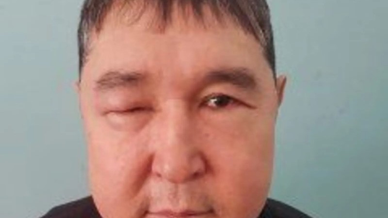 Умер вор в законе по прозвищу Голова - источник