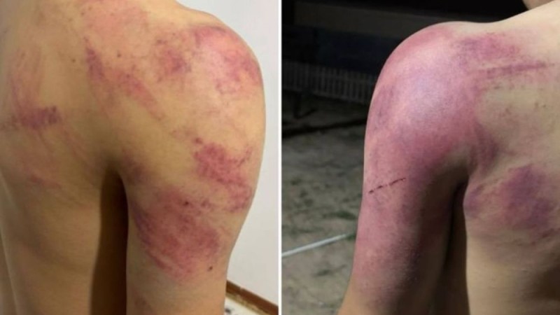 Восьмиклассников избили палками за отказ от работы в Атырау