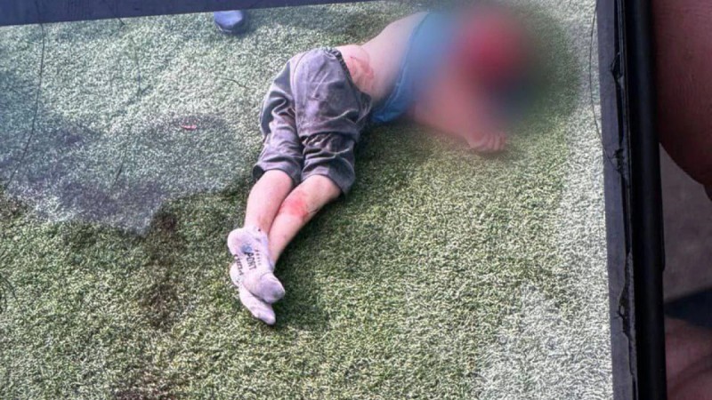 Нападение бойцовских собак на ребенка: виновных строго накажут