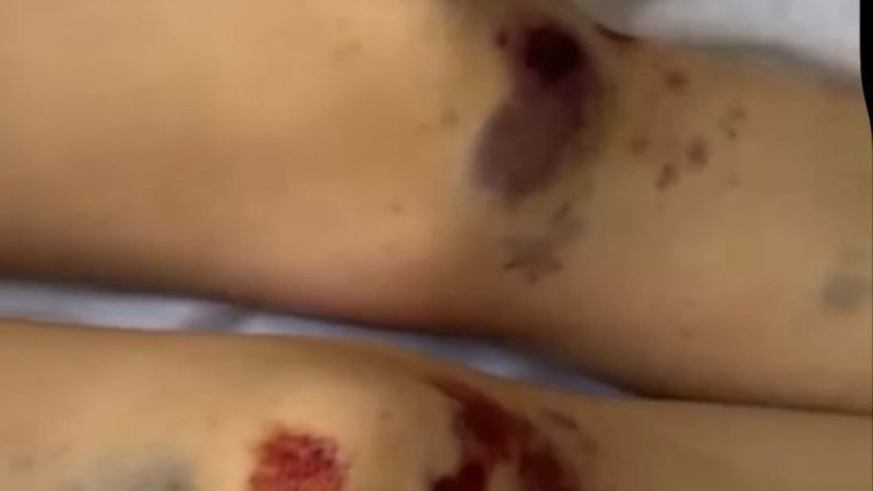 "Привязали к седлу и волокли по степи": жуткое убийство расследуют в области Жетісу